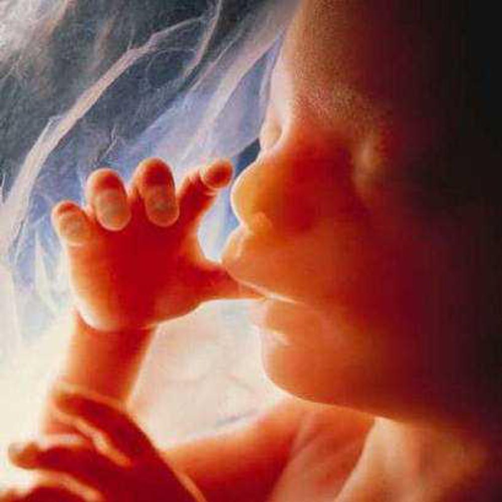 Fotos de fetos de 12 semanas abortados 84 Fotos de fetos de 12 semanas abortados 50