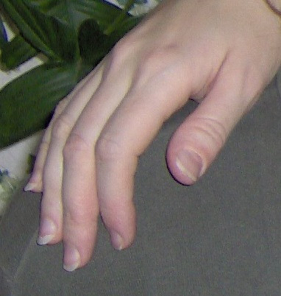 Утиные ногти: самый неоднозначный летний тренд из ТикТока 🦆