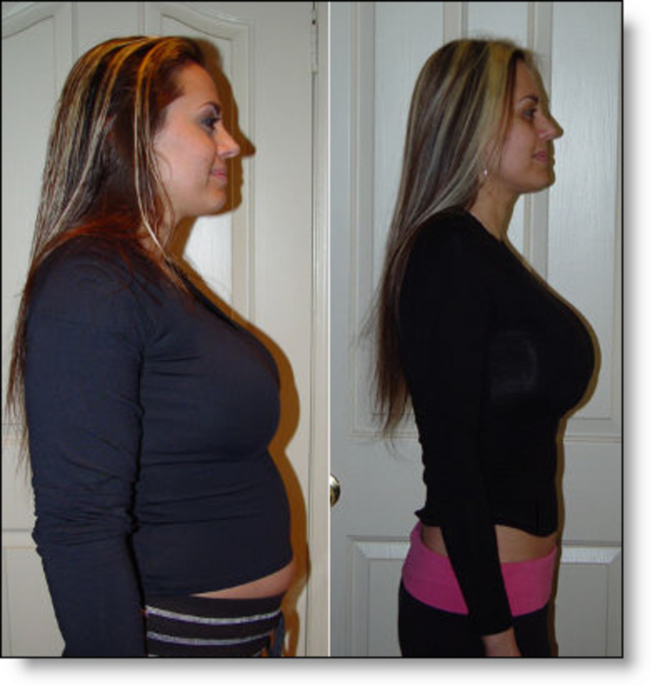 Похудела после рвоты без спорта Похудела после рвоты без спорта
