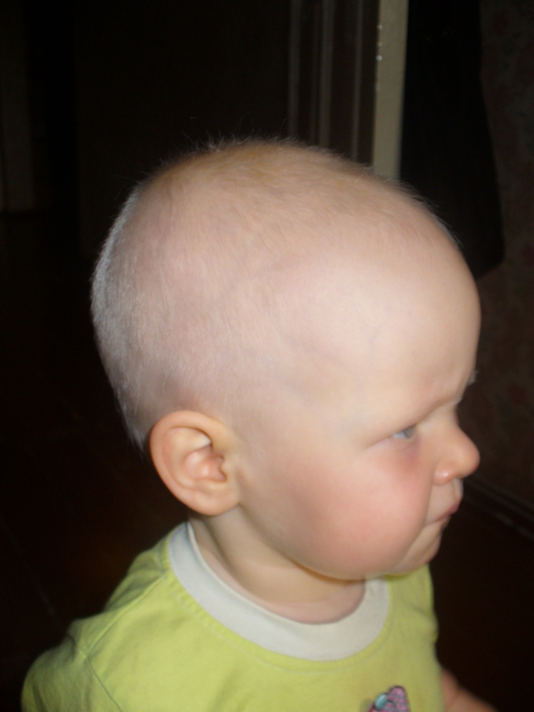 Маленький затылок. Необычная форма головы. Вытянутый затылок у ребенка. Форма головы у грудничка.