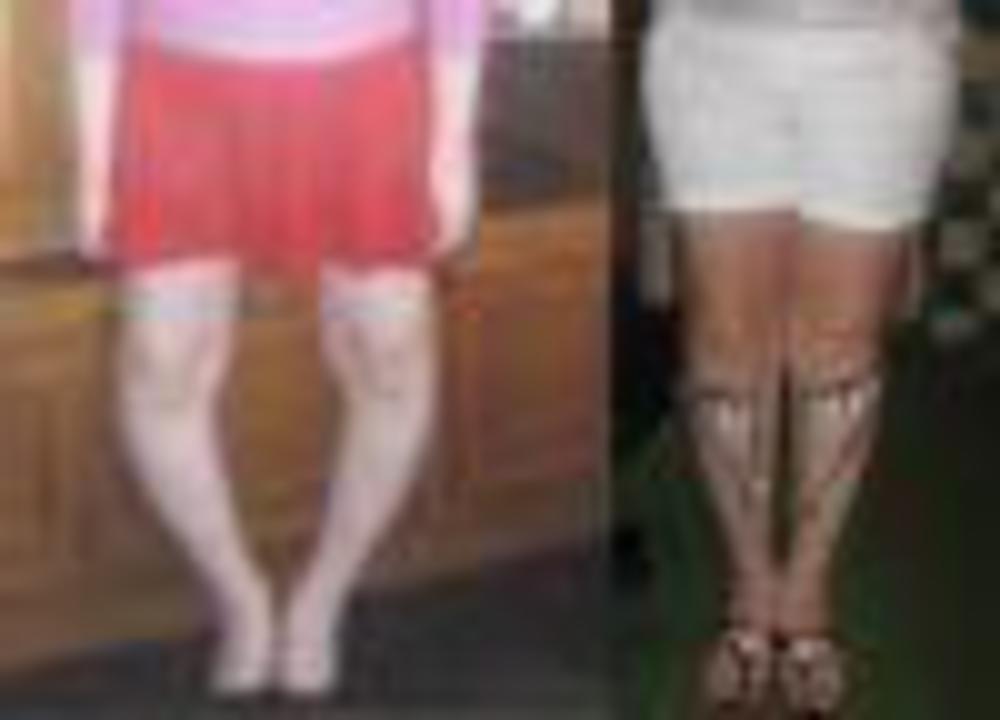 Какие ноги считаются кривыми у женщин фото