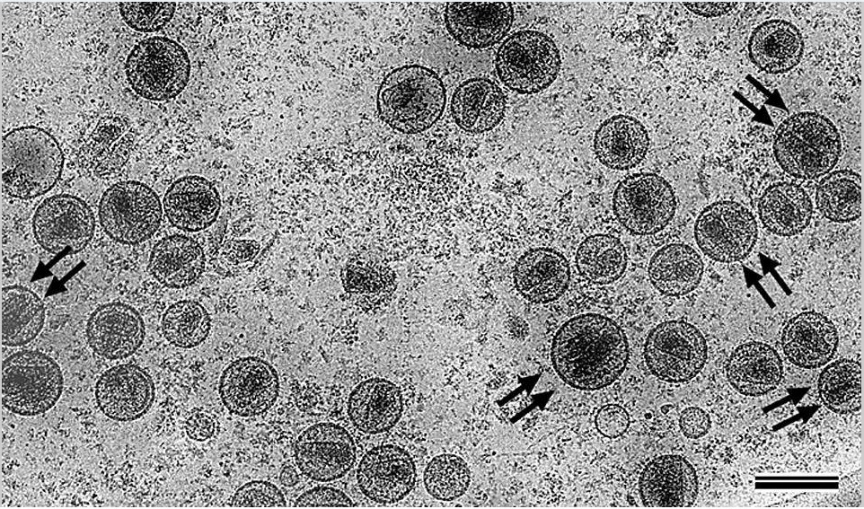 Фото вич вируса под микроскопом