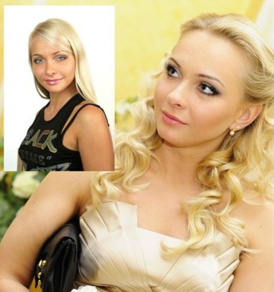 Участники Дом 2 После Пластики Фото
