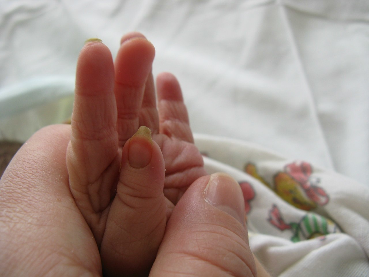 Ногти у новорожденных детей