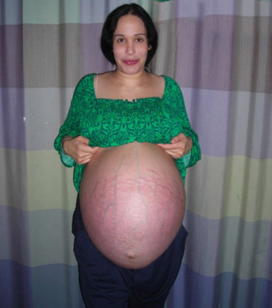 нарыла...в этом пузе 8 малышей...а мы со своими ахаем и охаем :D 