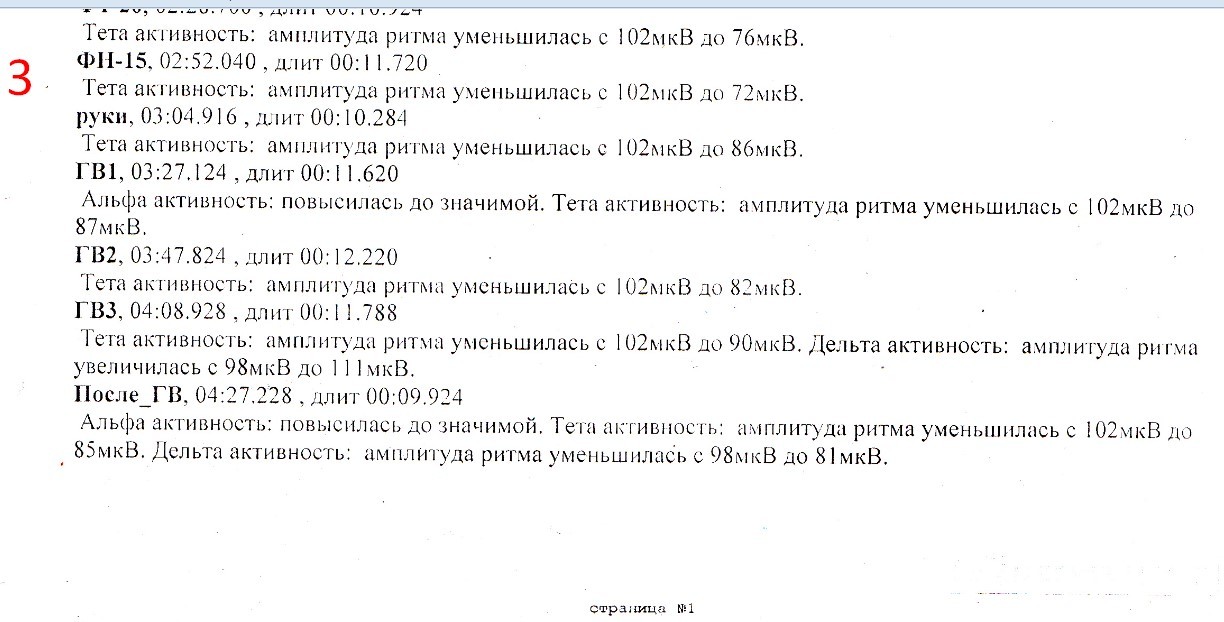 Альфа активность. Амплитуда Альфа активности. Тета активность. Средняя амплитуда Альфа ритма. 100 МКВ амплитуда Альфа активности.